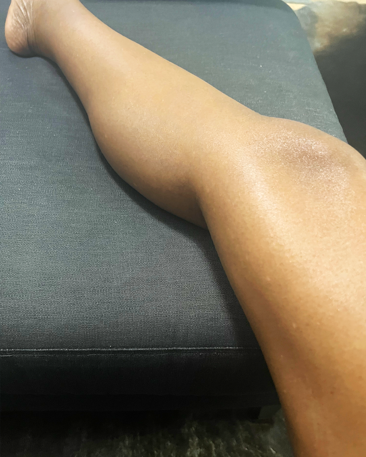 Healed skin on leg after product use